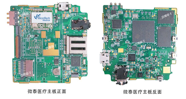 杭州迅得电子 | 微泰医疗设备主板组装 | 可穿戴医疗设备电路板组装服务